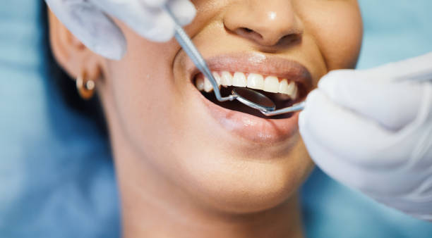 Best Emergency Wisdom Teeth Removal in Alvarado, TX
